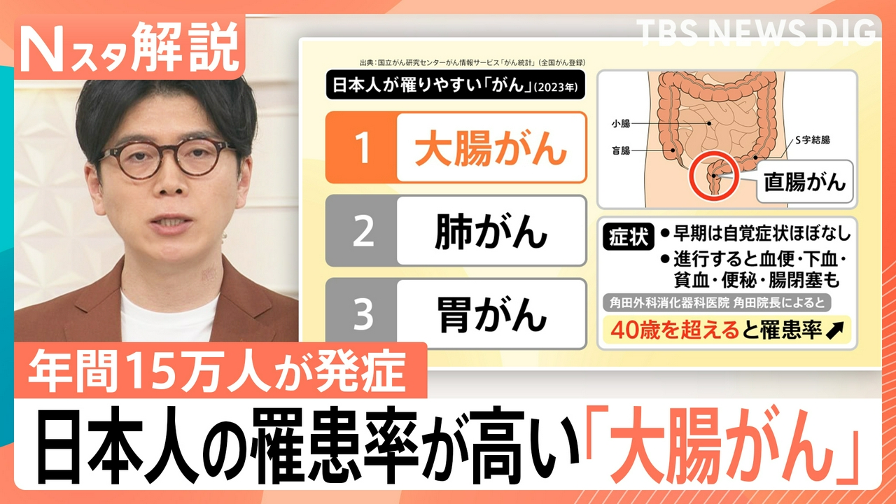 日本人の罹患率が高い「大腸がん」【Nスタ】