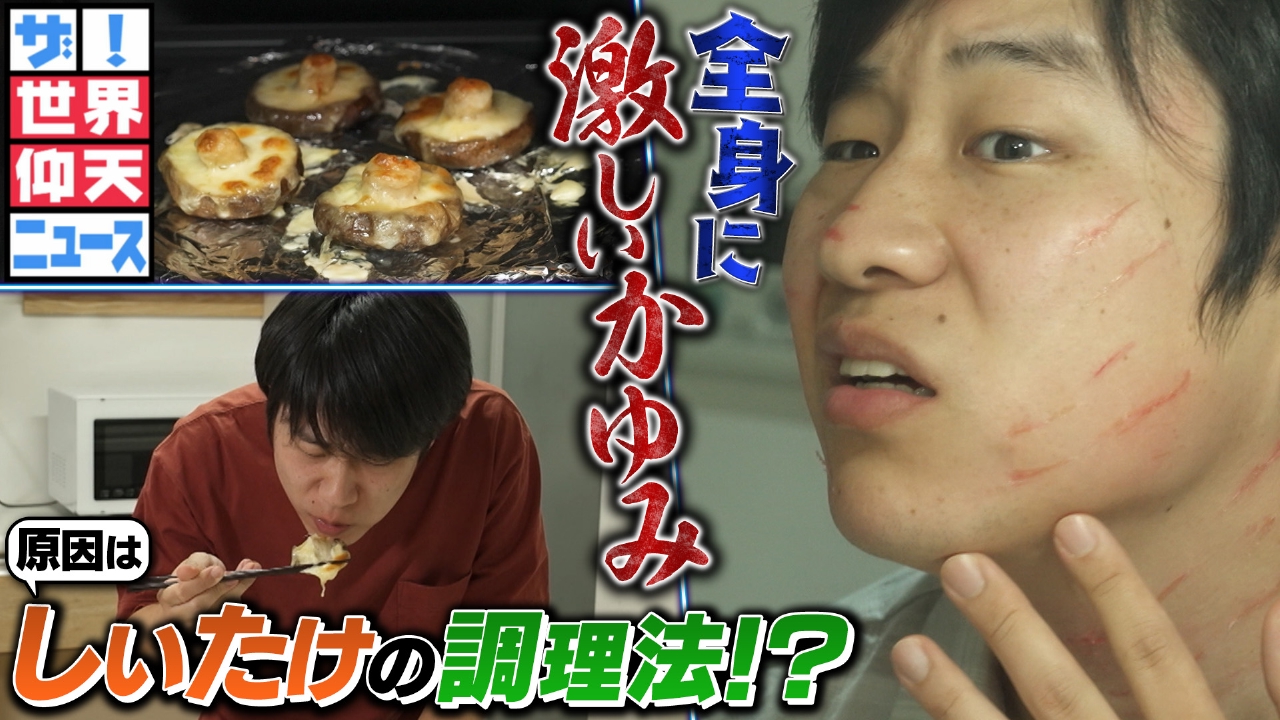 しいたけの美味しい食べ方を真似て全身にムチで打たれたような発疹が！