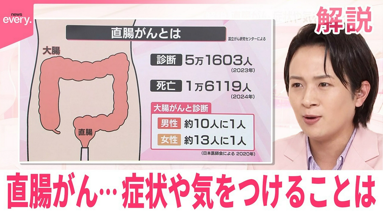 【解説】直腸がん…どういった病気なのか 症状や気をつけることは