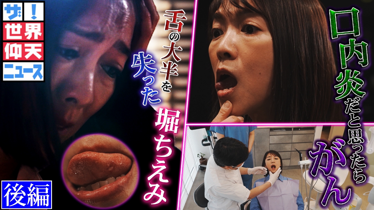 堀ちえみ がん発見が遅れた衝撃の理由 後編