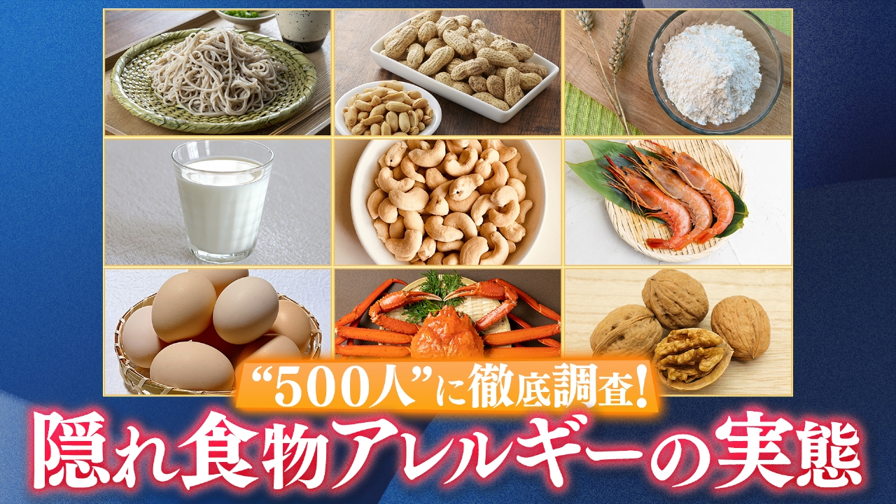 ＜緊急調査＞大人の食物アレルギー実態とは！？