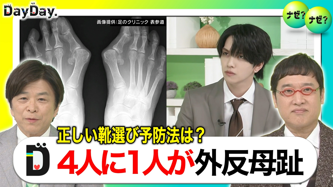 “裸足の季節”到来 外反母趾防ぐ「正しい靴の選び方」【ナゼ？ナゼ？】