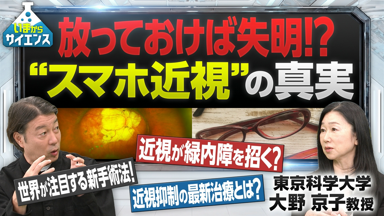 【放っておけば失明！？】急増中の“スマホ近視”から目を守れ 大野京子（東京科学大学・教授）
