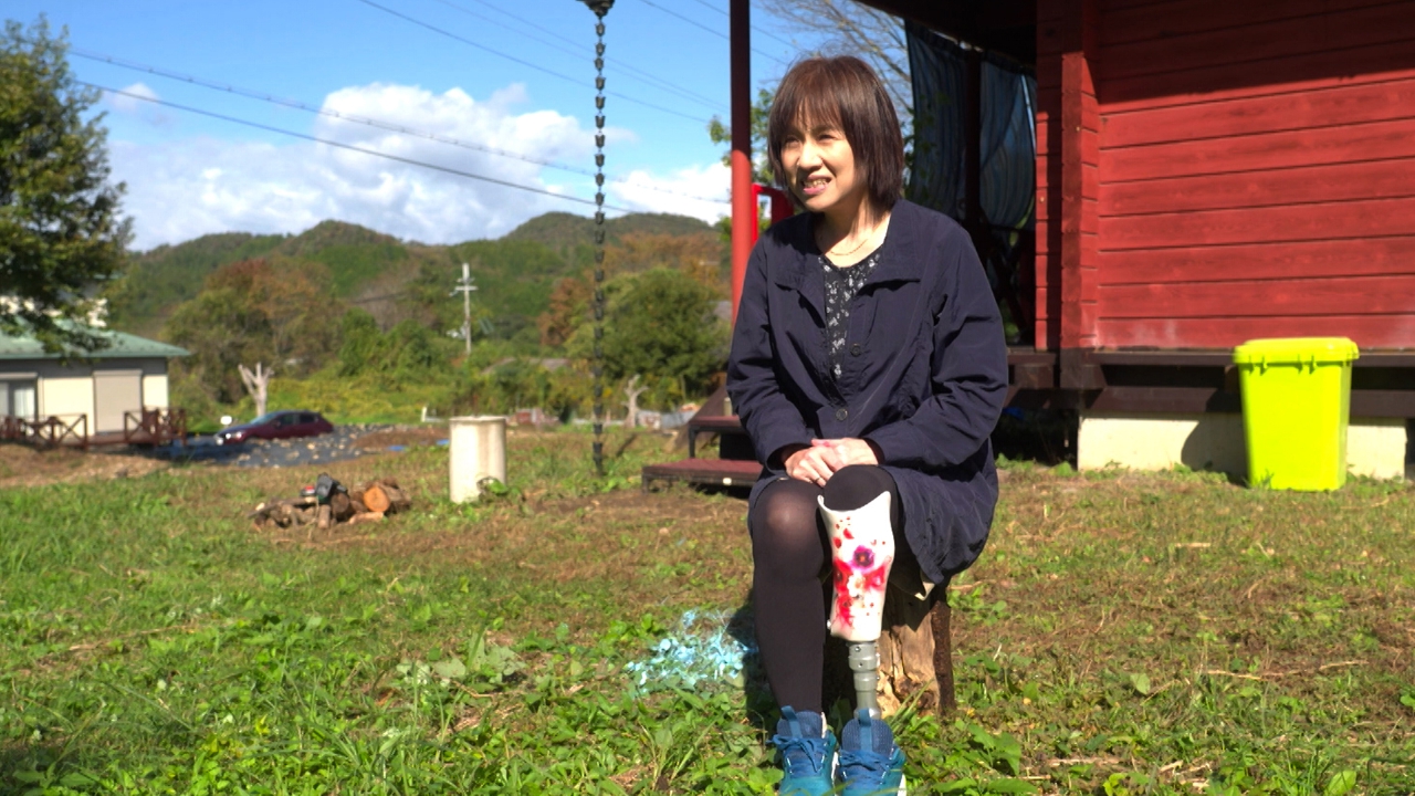 義足女性コミュニティ 理事 田中典子