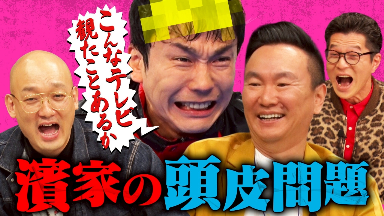 濱家の薄毛がやばい!!各局に配る「頭皮の取扱説明書」を作れ！