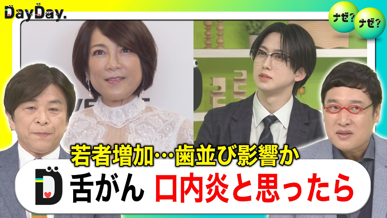 20年で倍増！若年層の「舌がん」“狭い歯並び”影響か　口内炎との違い【ナゼ？ナゼ？】