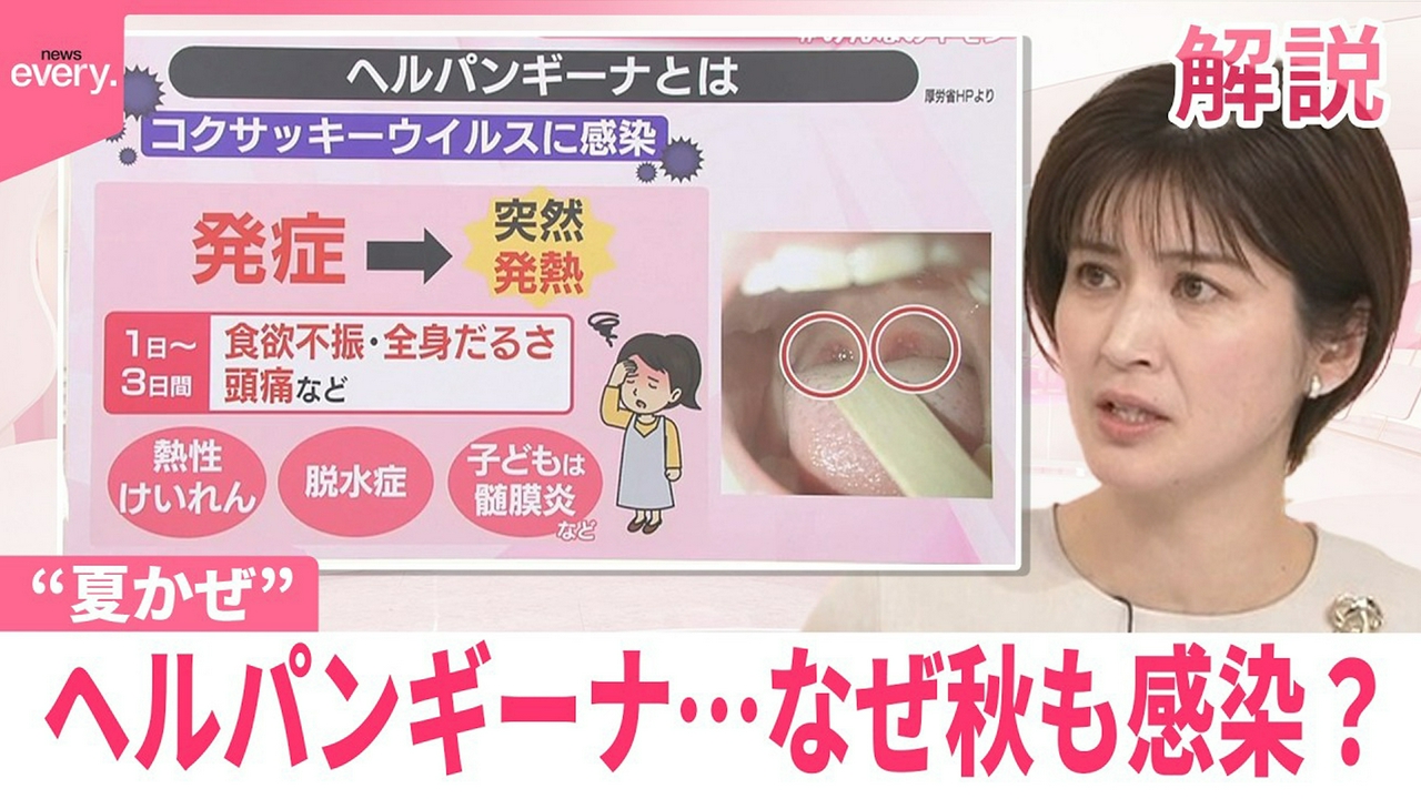 【#みんなのギモン】“夏かぜ”ヘルパンギーナ…なぜ秋も感染？ 長雨が関係か 注意することは？